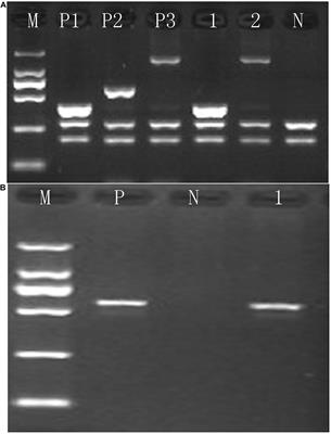 Molecular Characterization Analysis of Thalassemia and Hemoglobinopathy in Quanzhou, Southeast China: A Large-Scale Retrospective Study